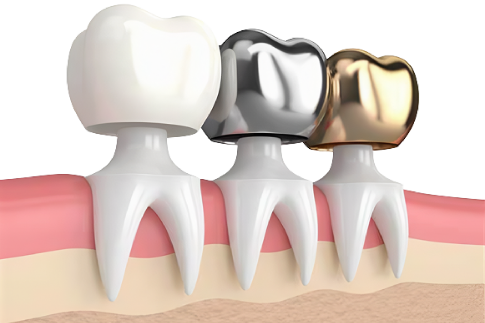 Endodoncia